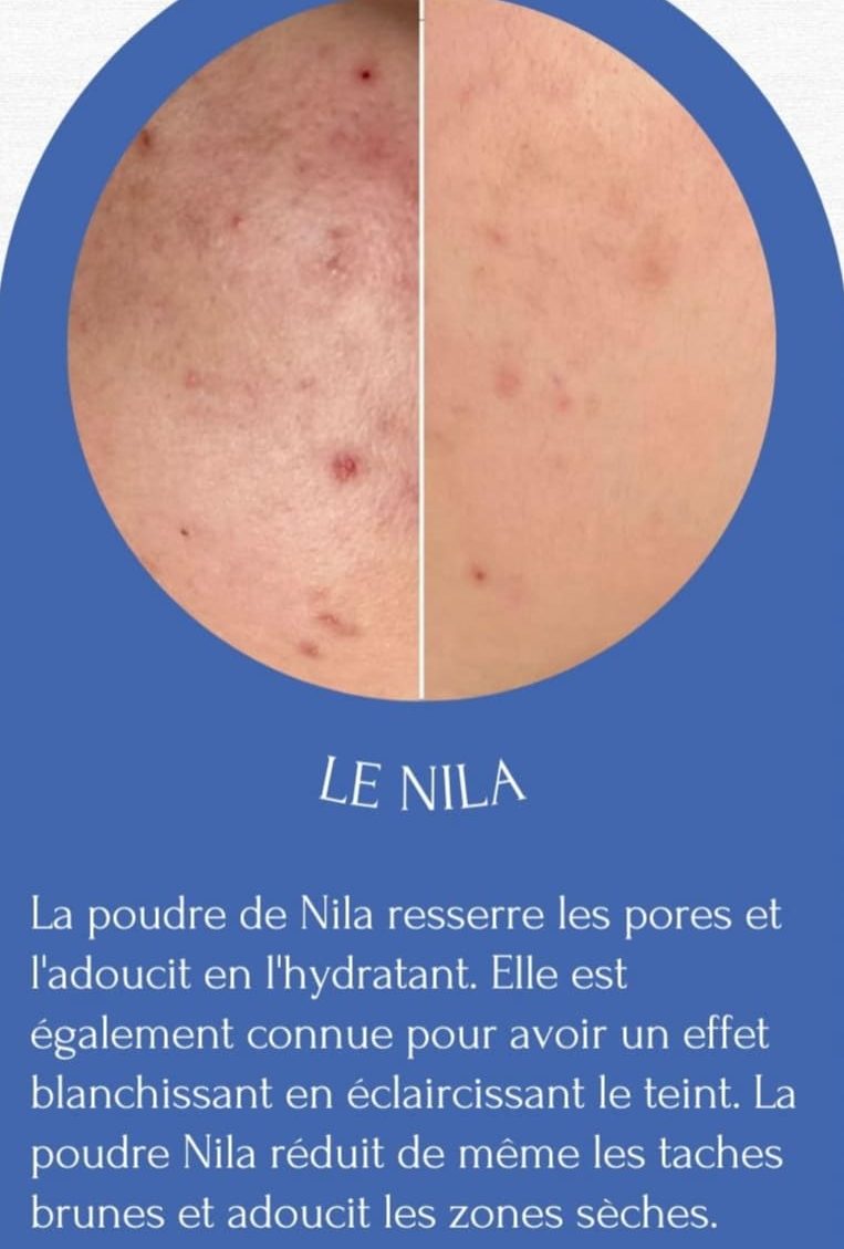 Vous êtes certain(e) de ne pas passer à côté d’un produit très demandé